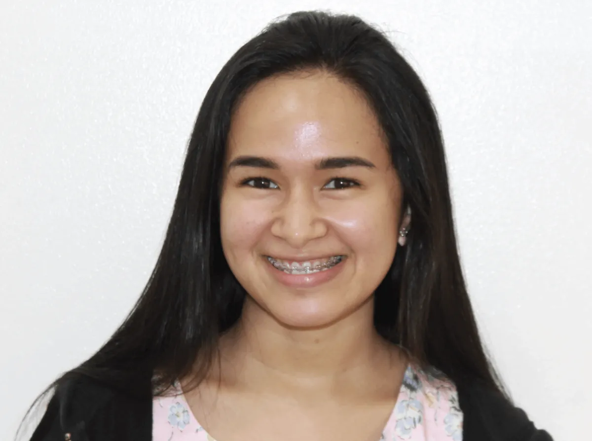 Smile makeover 1