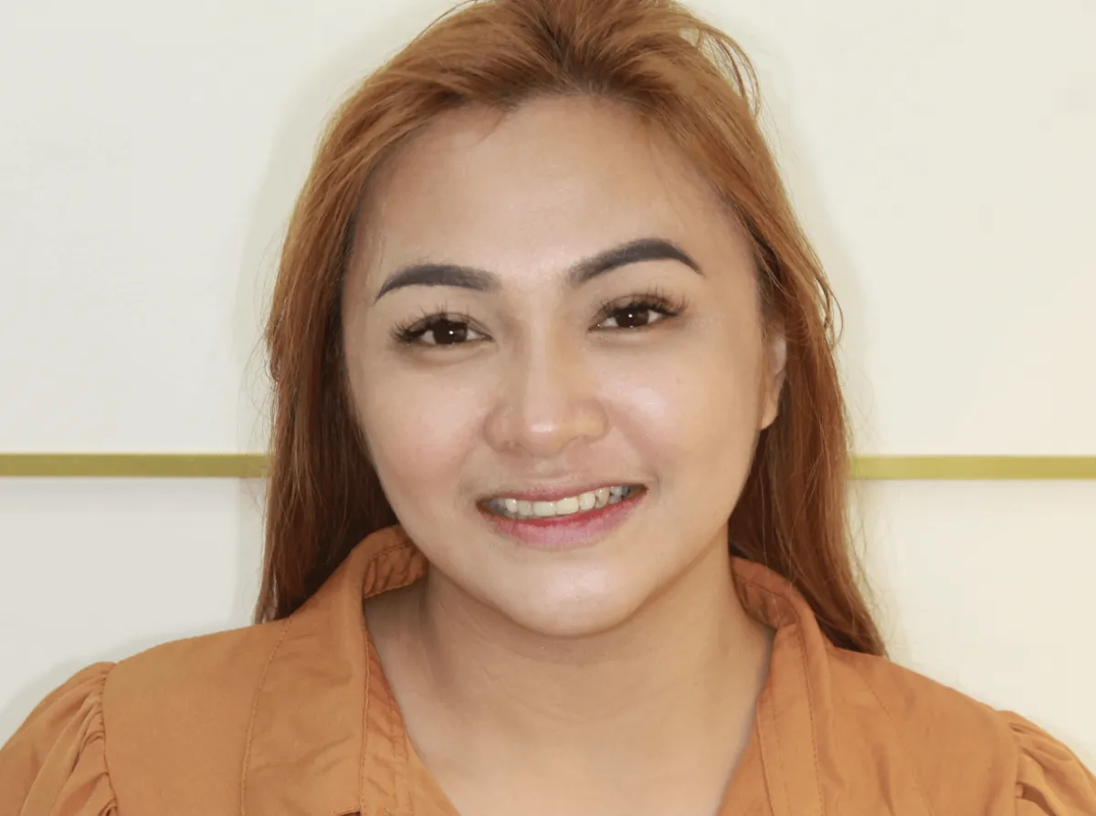 Smile makeover 5