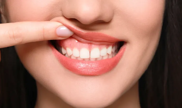 Gum Disease Treatment