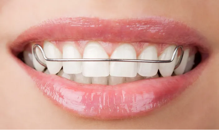 Retainers