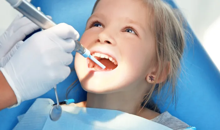 Dental Sealants